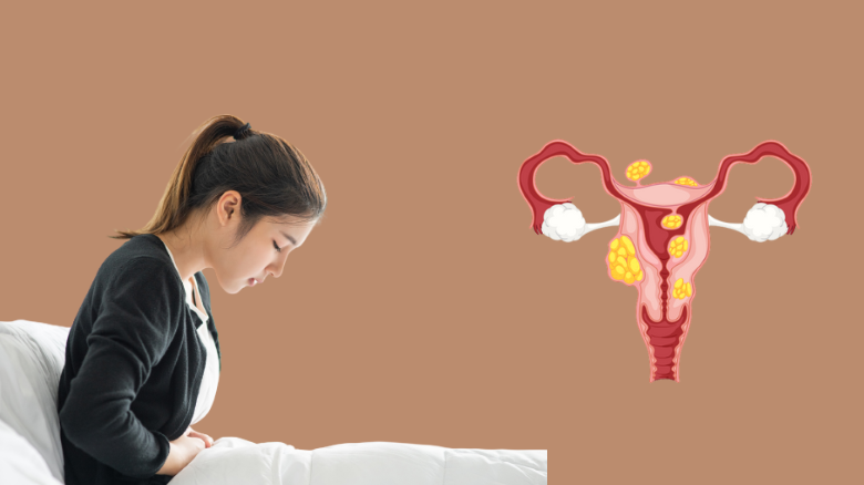 Breaking Free from Fibroids_ Your Journey to Effective Treatment