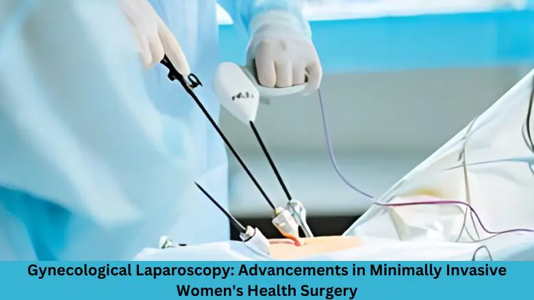 Gynecological Laparoscopy_ Advancements in Minimally Invasive Women's Health Surgery
