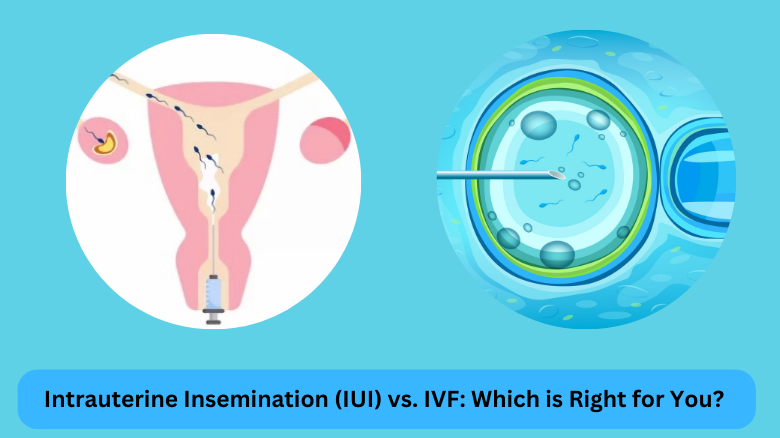 Intrauterine Insemination (IUI) vs. IVF Which is Right for You