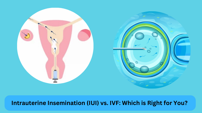 Intrauterine Insemination (IUI) vs. IVF_ Which is Right for You