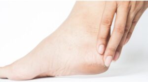 How to Prevent Swollen Feet During Pregnancy
